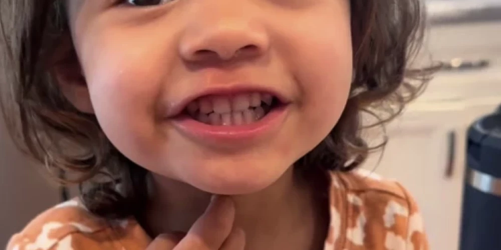 На кадрах видно, как маленькая Элла вдруг начинает чесать подбородок и шею.