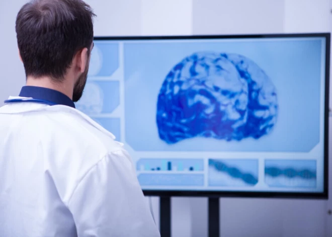 Неврологи бьют тревогу: Латвия не обеспечивает нормальную медицинскую помощь при болезни Паркинсона