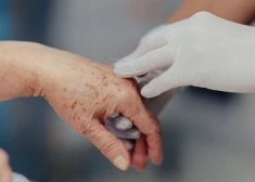 Slovēnijas jaunais likums par asistēto pašnāvību referendumā neiztur pārbaudi