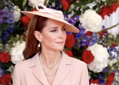 Keita Midltone beidzot atklāj, kas noticis ar viņas matiem