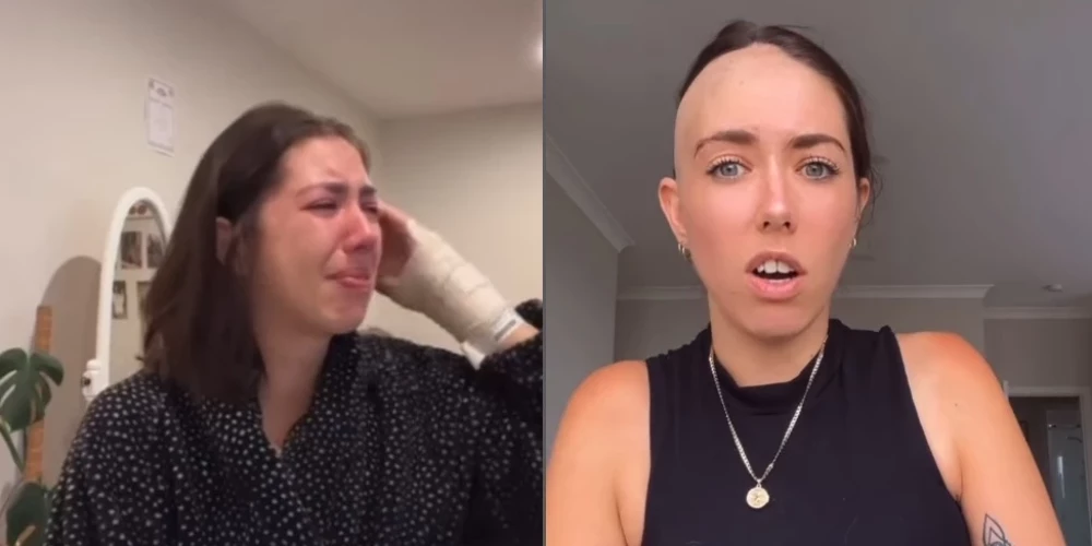 Пейдж из Новой Зеландии удивила онкологов