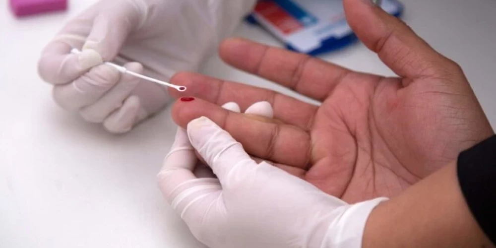 Pagājušajā gadā 45 cilvēki par to, ka ir HIV inficēti, uzzināja, slimībai esot jau vēlīnā jeb AIDS stadijā.