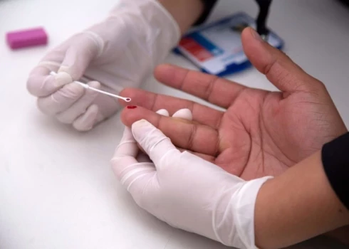 Pagājušajā gadā 45 cilvēki par to, ka ir HIV inficēti, uzzināja, slimībai esot jau vēlīnā jeb AIDS stadijā.