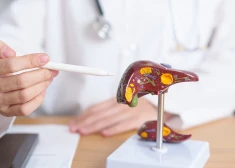 Спиваемся! От болезней печени, связанных с алкоголем, в Латвии в прошлом году умерли 219 человек