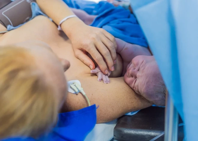 Vēlos ķeizargriezienu! Cik šāds "prieks" maksā Latvijas dzemdību nodaļās?