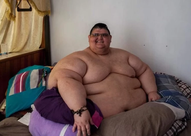 Miris savulaik resnākais cilvēks pasaulē, kurš pusotra gada laikā novājēja par 250 kilogramiem