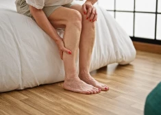 Divas brīdinošas pazīmes, kas liecina par augstu holesterīna līmeni