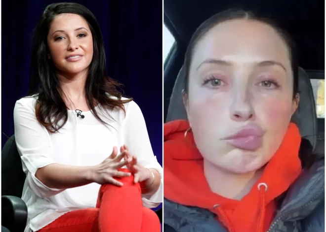 35 gadus veco politiķes meitu skārusi sejas paralīze; to izraisījis iemesls, kas var būt teju ikvienam