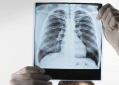 Доктор Апинис рассказал о болезни, которая в Латвии убивает много людей, но о которой не принято говорить