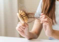 В Латвии держится мороз - многие замечают выпадение волос: дерматологи назвали главные зимние причины