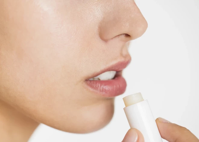 Зима - идеальное время для герпеса. Фармацевт объясняет, как защитить губы в сезон отопления