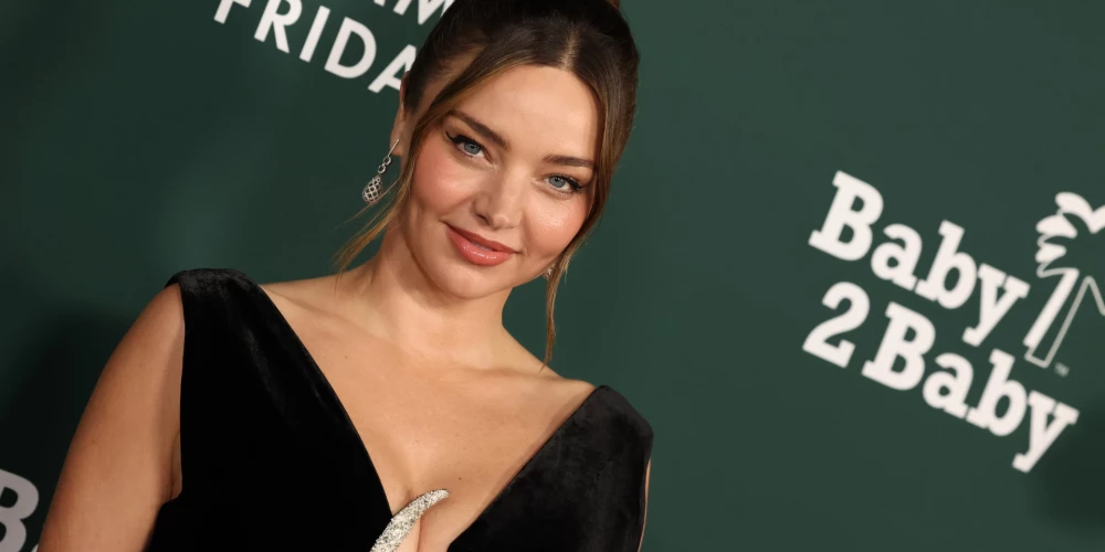 Миранда Керр призналась, что не исключает подтяжку лица в будущем.