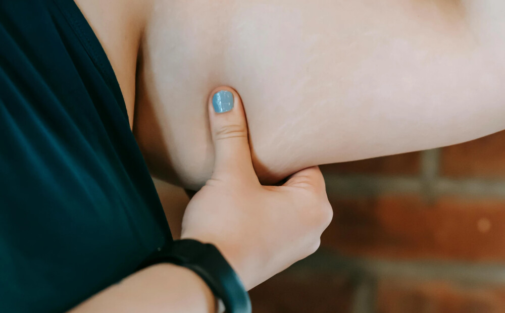 Sieviete četru mēnešu laikā zaudē 27 kilogramus: "Šis ēdiens izpostīja manu dzīvi!"