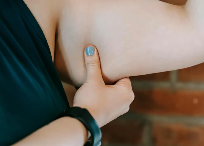 Sieviete četru mēnešu laikā zaudē 27 kilogramus: "Šis ēdiens izpostīja manu dzīvi!"