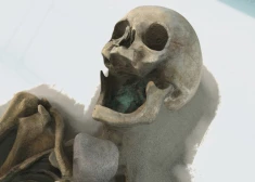 No mūmiju pulvera līdz Frankenšteinam: vēsturē dīvainākās ārstniecības metodes