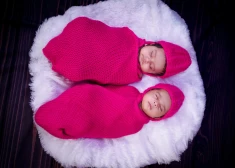 Kā dzīvesveids atspoguļojas sejā: dvīņu piemērs