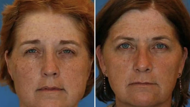 FOTO: Amerikas Plastisko ķirurgu biedrība