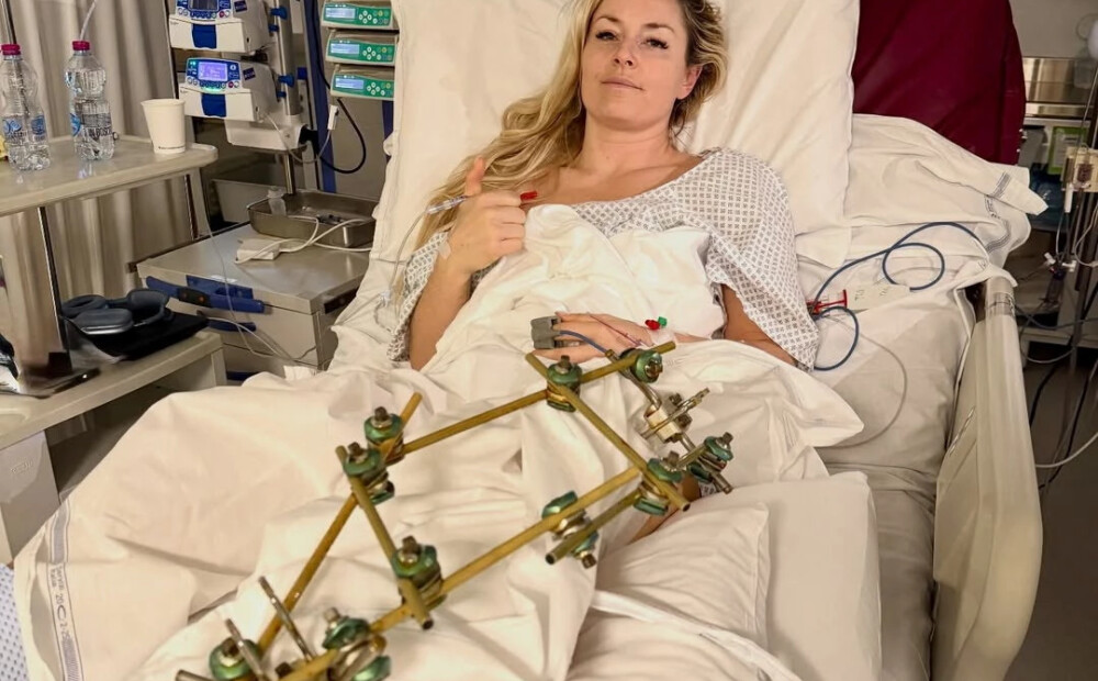 “Veiksme tagad nozīmē ko citu!" ASV kalnu slēpotāja Lindsija Vona pēc trešās operācijas publicē foto