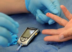 Kā samazināt cukura līmeni asinīs bez medikamentiem: eksperti nosauc vienkāršāko veidu