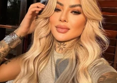 Pēc kosmētiskās operācijas mirusi Brazīlijas influencere Bjanka Diāsa