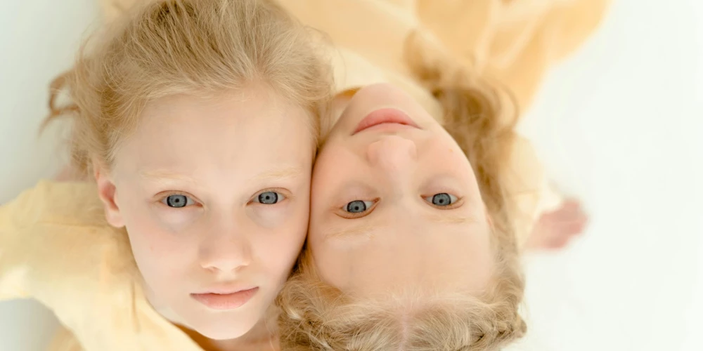 Kā atšķirt identiskus dvīņus?