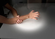 Синдром чужой руки и другие самые странные неврологические состояния