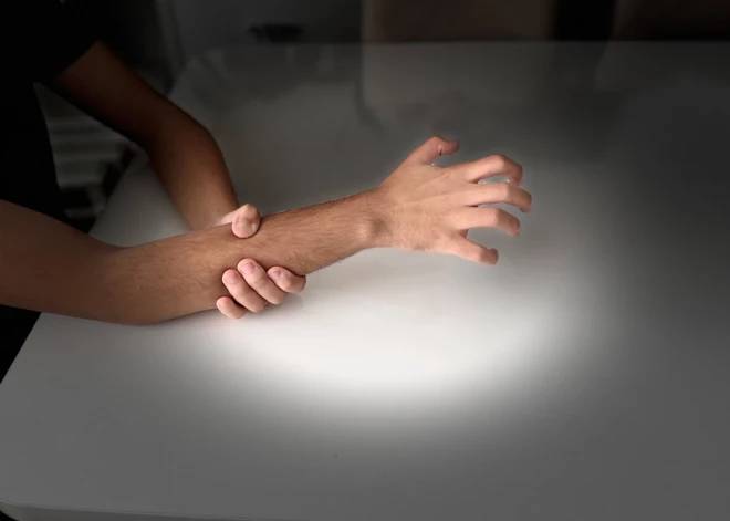 Синдром чужой руки и другие самые странные неврологические состояния