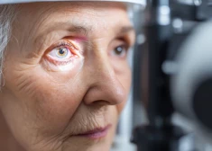 Glaukomas risks sākas klusumā – vai esat pārbaudījis acu spiedienu?