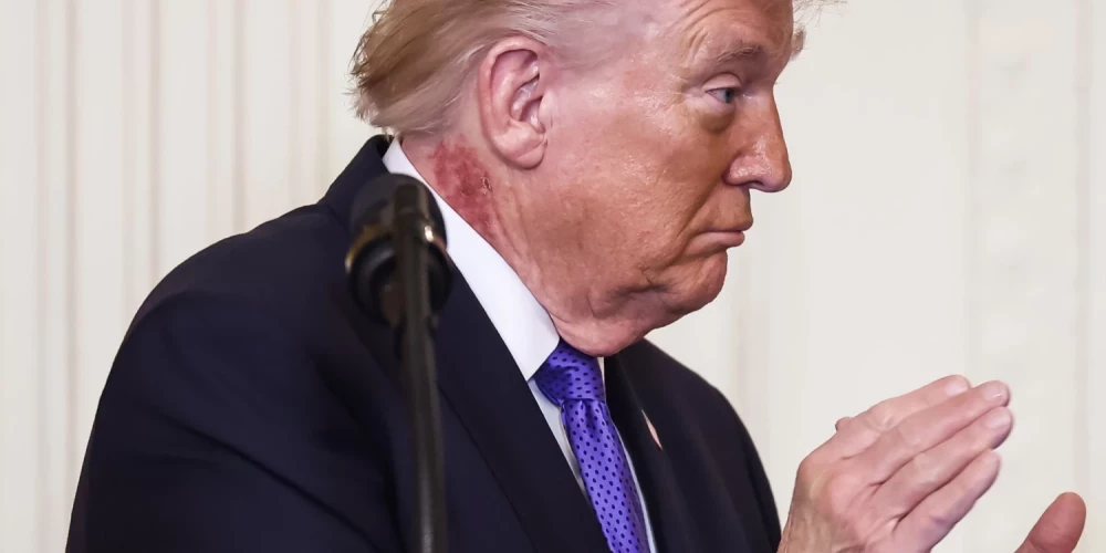 Что же это за пятно на шее Трампа?