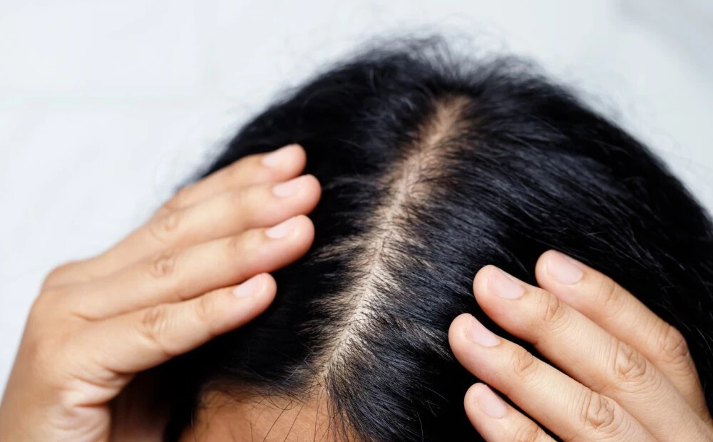 Kāpēc mati pēc ziemas zaudē dzīvīgumu? Zinātnieces ieteikumi matu struktūras atjaunošanai