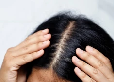 Kāpēc mati pēc ziemas zaudē dzīvīgumu? Zinātnieces ieteikumi matu struktūras atjaunošanai