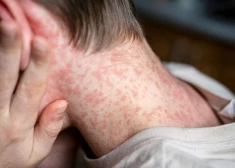 Masalu draudi: trīs pasākuma "Ļutaurus viktorīna" dalībnieki sazinājušies ar Slimību profilakses un kontroles centru 