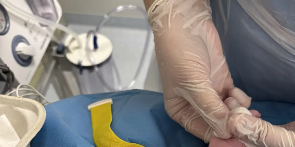 Новорожденная на операционном столе через минуты после родов.