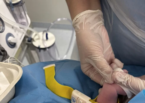 Новорожденная на операционном столе через минуты после родов.