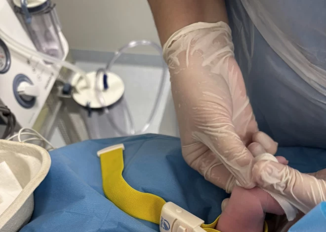 Медики двух больниц провели экстренную операцию новорожденной: редчайший случай в Латвии