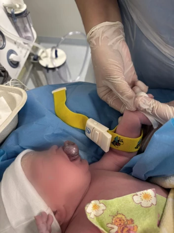 Новорожденная на операционном столе через минуты после родов.