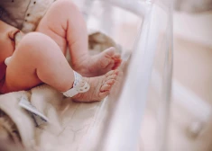 Stradiņa slimnīcā sekmīgi operēts jaundzimušais ar retu veidojumu mutē