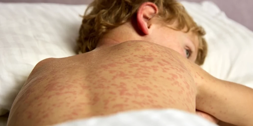 Иллюстративное фото.