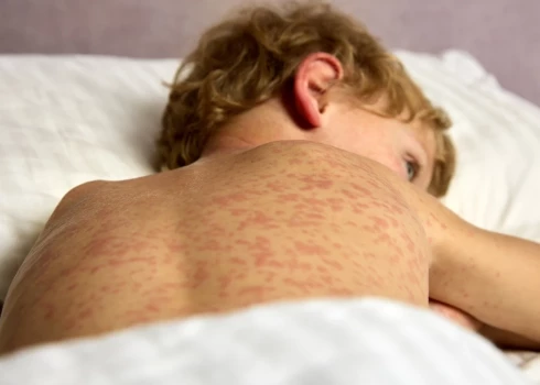 Иллюстративное фото.