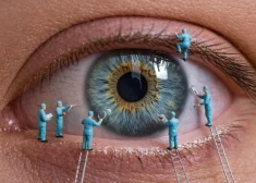 Klusais redzes zaglis: kā laikus pamanīt glaukomu un pasargāt redzi