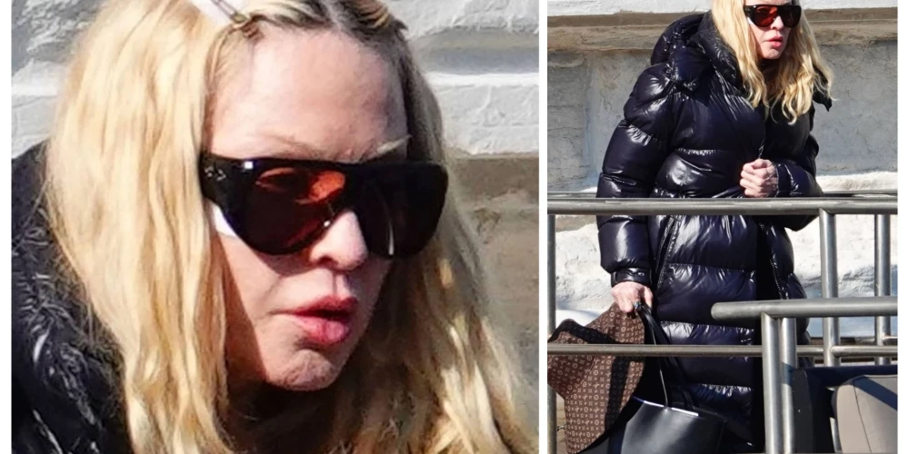 Madonna Venēcijā slēpj plāksteri uz vaiga un vēlas palikt neatpazīta.