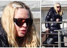 Madonna redzēta Venēcijā ar dīvainu pārsēju uz sejas. Fani satraukušies