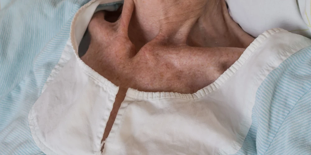 Иллюстративное фото.