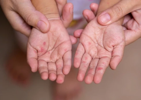 Иллюстративное фото.