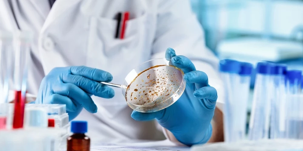 У большинства людей с повышенным уровнем липопротеина нет заметных симптомов, поэтому единственный способ его определить — анализ крови.