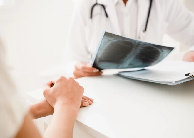 Aptuveni 30% gadījumu tuberkuloze tiek atklāta novēloti. Kāpēc tā? 