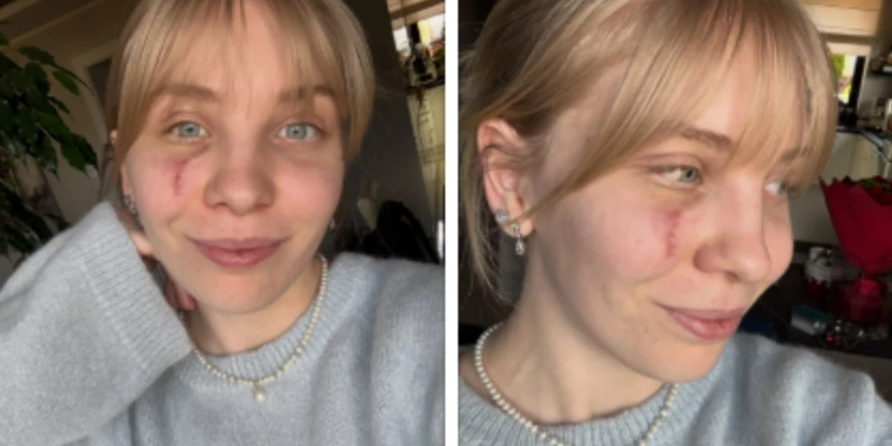 Ekrānuzņēmums no Instagram