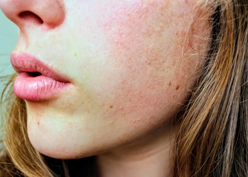 Ilustratīvs attēls.