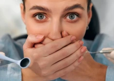 Šī kļūda var maksāt zobus: cik bieži ir jāiet pie higiēnista