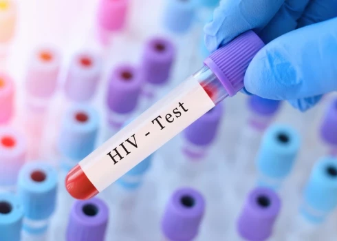 Этот анализ может спасти жизнь.